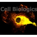 Human Diseased Cells (Diabetic Cells, Hypertension, Smoke Cells)